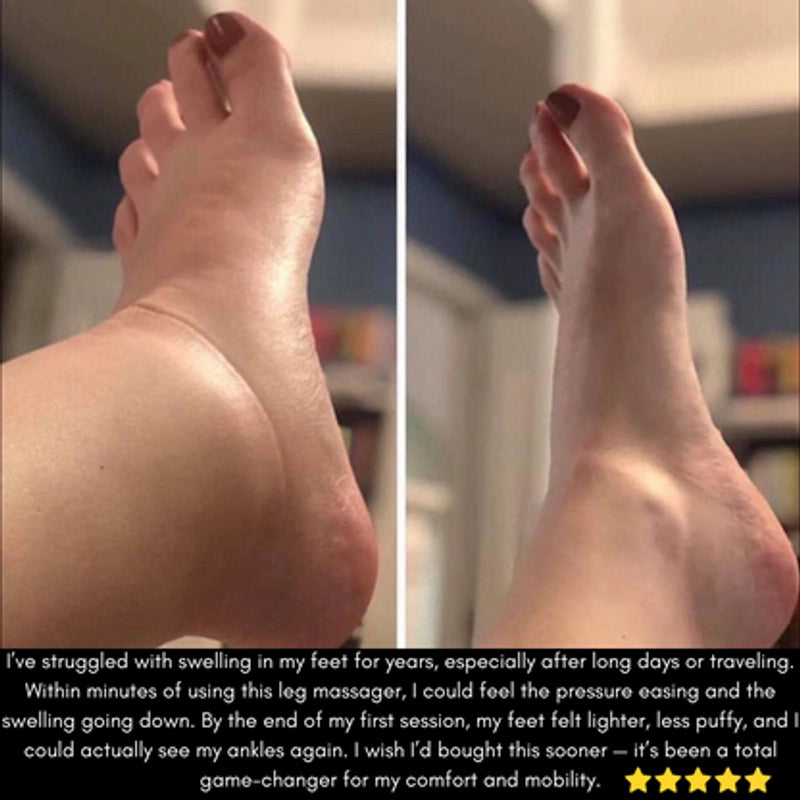 AURALAX™ Complete Leg Recovery Bundle | Circulation & Lymphatic Relief Kit | Bonus Calf Massager